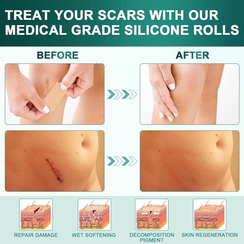 Silicone Scar Sheets – Heal, Fade & Protect