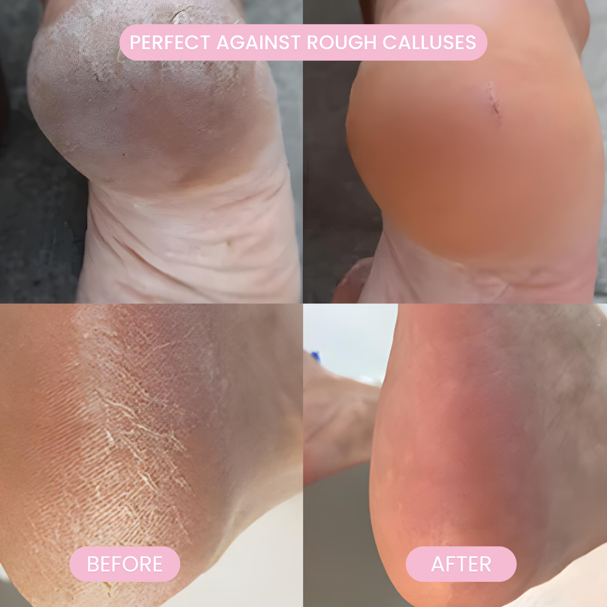 The Footsilk Pro (FREE)